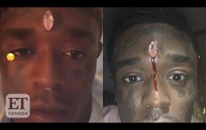 Lil Uzi Vert Gets Diamond Piercing In Forehead